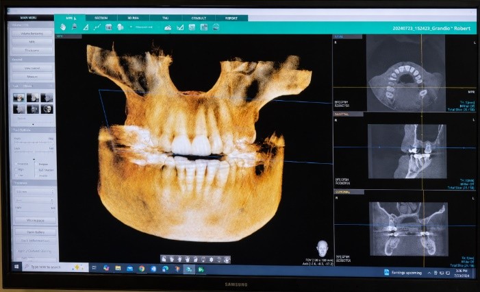 Calm Dental Care's in-office 3D CBCT (cone beam) scan